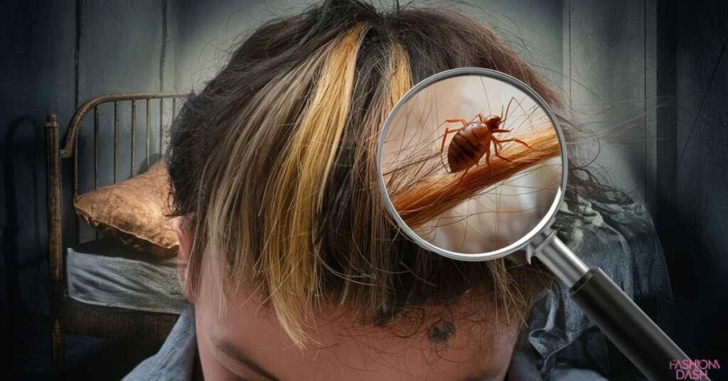 Can Bed Bugs Get In Your Hair